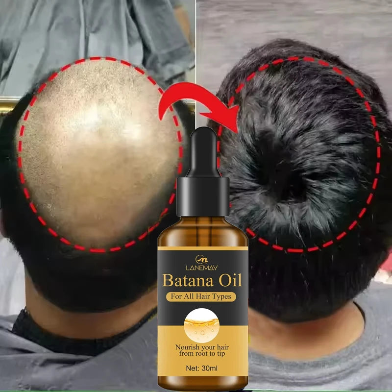 BatanaBoost™ 7-Day Hair Growth & Repair Serum – Anti-Loss Oil for Men & Women