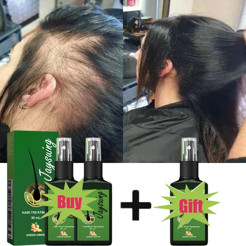GroMax™ Fast Hair Growth Serum Spray – Anti-Hair Loss & Root Repair Treatment for Men & Women