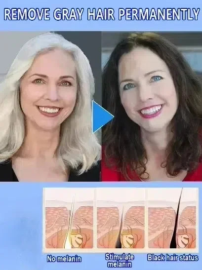 ReColorX™ — 2025 White Hair Eliminator & Natural Pigment Restorer
