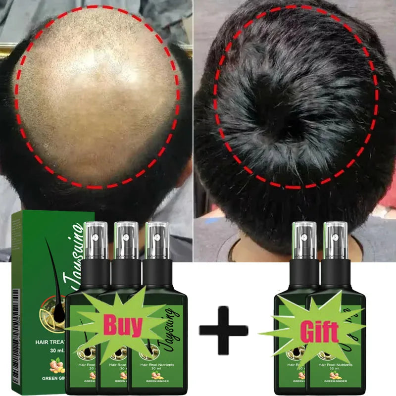 GroMax™ Fast Hair Growth Serum Spray – Anti-Hair Loss & Root Repair Treatment for Men & Women