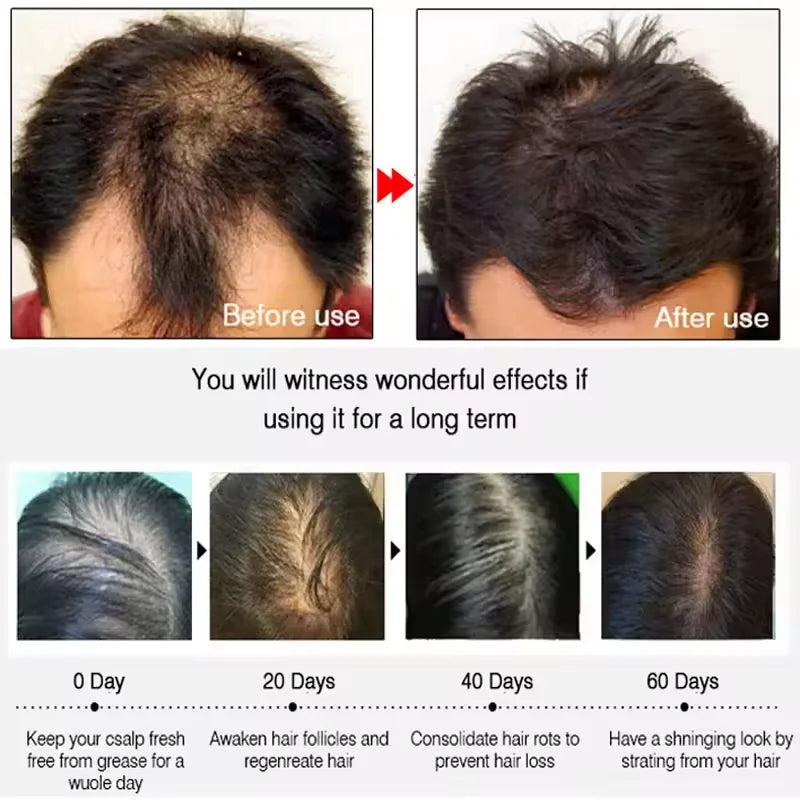BatanaBoost™ 7-Day Hair Growth & Repair Serum – Anti-Loss Oil for Men & Women