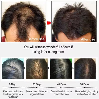 BatanaBoost™ 7-Day Hair Growth & Repair Serum – Anti-Loss Oil for Men & Women