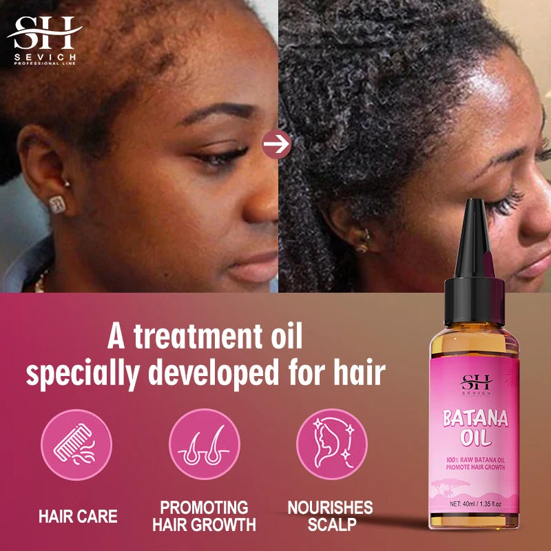 BatanaGlow™ 100% Pure Batana Oil Hair Butter – Restore Growth & Repair Bald Spots Naturally