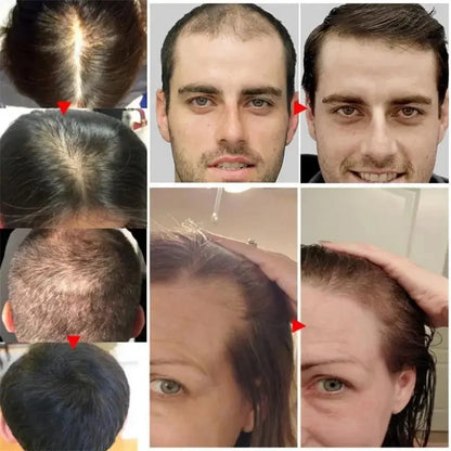 BatanaBoost™ 7-Day Hair Growth & Repair Serum – Anti-Loss Oil for Men & Women