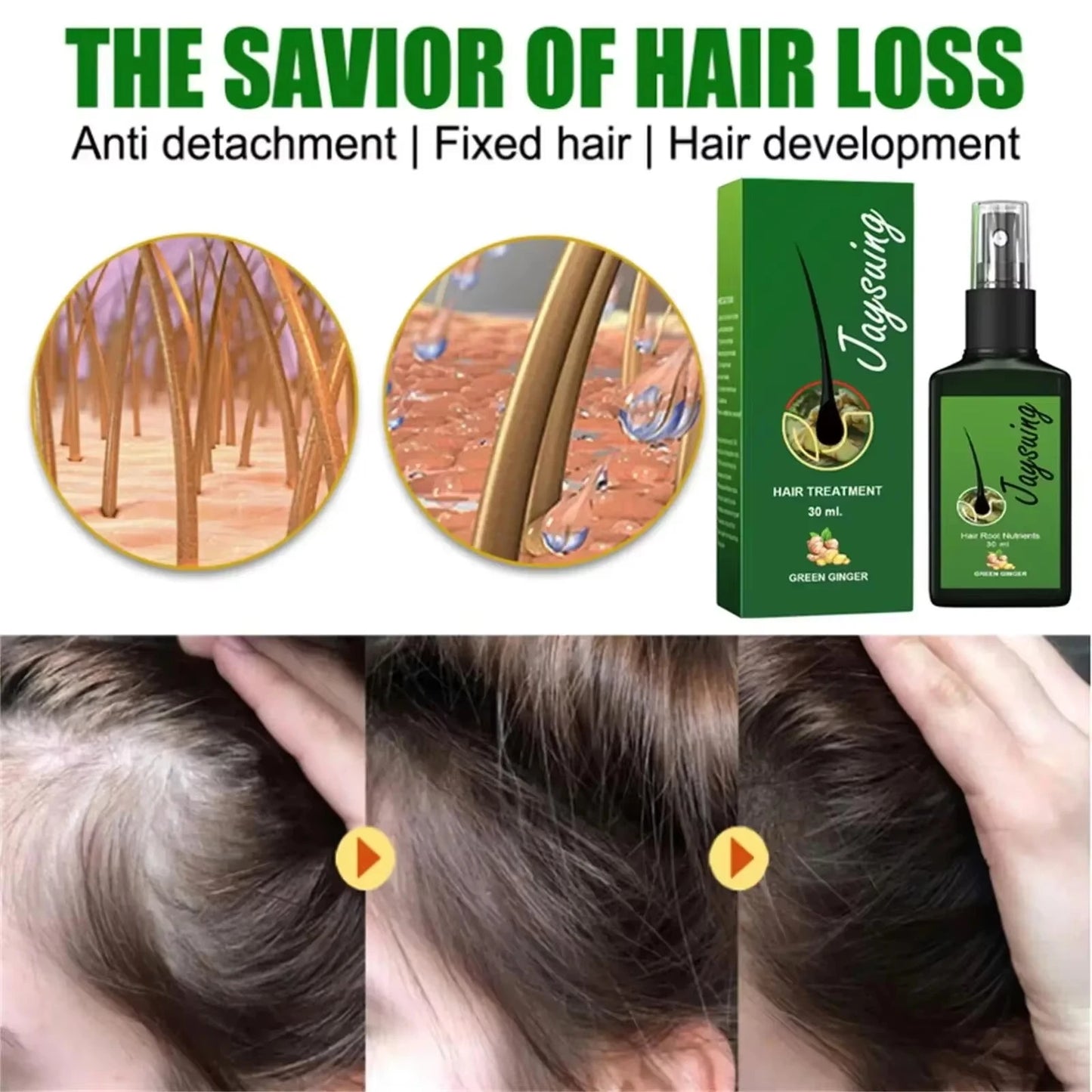 GroMax™ Fast Hair Growth Serum Spray – Anti-Hair Loss & Root Repair Treatment for Men & Women