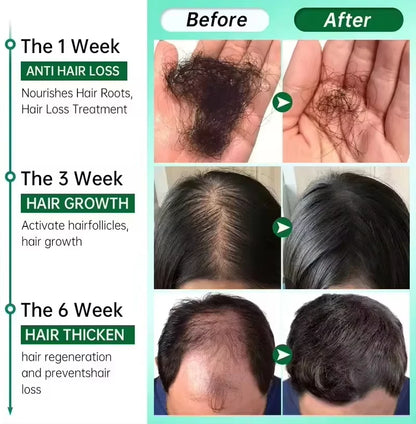 GroMax™ Fast Hair Growth Serum Spray – Anti-Hair Loss & Root Repair Treatment for Men & Women