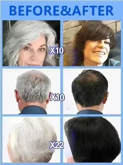 ReColorX™ — 2025 White Hair Eliminator & Natural Pigment Restorer